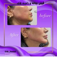 تخفیف بوتاکس،فیلر،هایفو،کربوکسی،مزوژل|خدمات آرایشگری و زیبایی|تهران, سازمان برنامه|دیوار