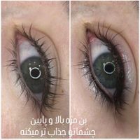 میکروبلیدینگ و میکروپیگمنتیشن صورت الی|خدمات آرایشگری و زیبایی|تهران, هفت چنار|دیوار