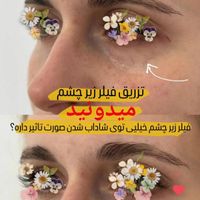 تزریق ژل (فیلر) وبوتاکس و لیفت بانخ ومادلینگ|خدمات آرایشگری و زیبایی|تهران, نارمک|دیوار