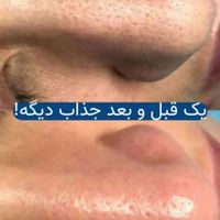 فیشال تخصصی درمانی قم|خدمات آرایشگری و زیبایی|قم, انسجام|دیوار