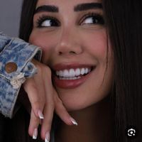 کامپوزیت دندان|خدمات آرایشگری و زیبایی|تهران, تهرانپارس شرقی|دیوار