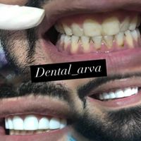 کامپوزیت وترمیم دندان|خدمات آرایشگری و زیبایی|آبادان, |دیوار