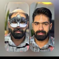 پروتز مو|خدمات آرایشگری و زیبایی|بانه, |دیوار