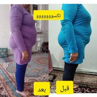 کوره چربیسوز|آرایشی، بهداشتی، درمانی|تهران, آرژانتین|دیوار