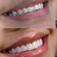 ابدارچی خانم برای مطب باروابط عمومی بالا|استخدام سرایداری و نظافت|تهران, سلسبیل|دیوار
