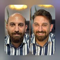 مرکز ترمیم مو /ایران مو /|خدمات آرایشگری و زیبایی|اصفهان, آفاران|دیوار