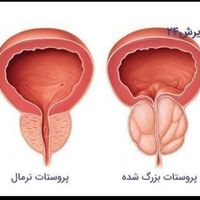 درمان قطعی وریشه ای پروستات|خدمات آرایشگری و زیبایی|تهران, یوسف‌آباد|دیوار