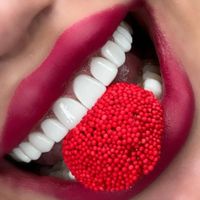 کامپوزیت دندان ایمپلنت لمینیت|خدمات آرایشگری و زیبایی|تهران, میدان ولیعصر|دیوار