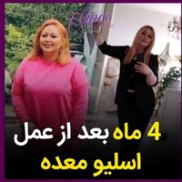 جراحی عمل اسلیومعده/اسلیو معده/چاقی لاغری/بایپس|خدمات آرایشگری و زیبایی|تهران, میدان ولیعصر|دیوار