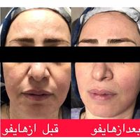 کلینیک پوست و مو و لیزر شهرری|خدمات آرایشگری و زیبایی|تهران, ظهیرآباد|دیوار