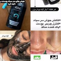 مشاور پوست و مو روتین پوستی کرم های ضدجوش لک چروک|آرایشی، بهداشتی، درمانی|تهران, باغ فیض|دیوار