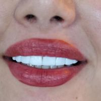 کامپوزیت دندان فقط 8500هر فک نقد و چک|خدمات آرایشگری و زیبایی|رشت, گلسار|دیوار