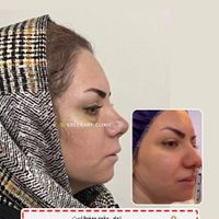 جشنواره جراحی و عمل بینی/لیفت/پلک|خدمات آرایشگری و زیبایی|کرج, درختی|دیوار