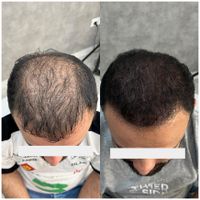 موهاتو پرپشت کن در سه ساعت|خدمات آرایشگری و زیبایی|تهران, صادقیه|دیوار