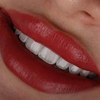 کامپوزیت دندان روکش لمینیت بلیچینگ دندانپزشکی|خدمات آرایشگری و زیبایی|تهران, سعادت‌آباد|دیوار