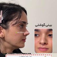 جشنواره جراحی و عمل بینی/لیفت/پلک|خدمات آرایشگری و زیبایی|کرج, درختی|دیوار