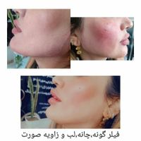 آموزش ژل وبوتاکس و پاکسازی|خدمات آموزشی|تهران, افسریه|دیوار