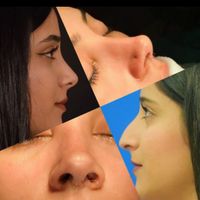 عمل جراحی بینی 19میلیون (بدون هزینه کلینیک)|خدمات آرایشگری و زیبایی|تهران, سهروردی|دیوار