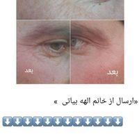 فیشال وپاکسازی صورت|آرایشی، بهداشتی، درمانی|تهران, حمزه‌آباد|دیوار