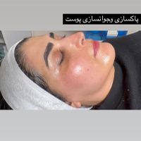 جشنواره پاکسازی پوست،لیفت،اکستنشن،ناخن،رنگ ولایت|خدمات آرایشگری و زیبایی|تهران, پاسداران|دیوار