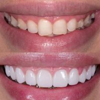 کلینیک تخصصی ایمپلنت و دندانپزشکی نسترن|خدمات آرایشگری و زیبایی|تهران, سهروردی|دیوار