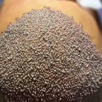 کاشت مو و ابرو به روش شیراز در اصفهان(اقساطی)|خدمات آرایشگری و زیبایی|اصفهان, مرداویج|دیوار