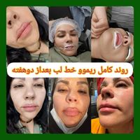 مرکزریموودرمانی (پاک)تاتوصورت،سلول بنیادی درمانی|خدمات آرایشگری و زیبایی|تهران, تهرانپارس غربی|دیوار