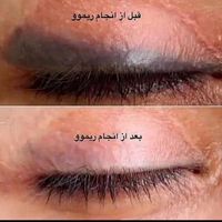 انجام وآموزش کاورابروهای تتودار.میکرو.رژلب.ریموو|خدمات آرایشگری و زیبایی|قم, سالاریه|دیوار