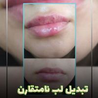 لیزرموی زایدتضمینی ژل وبوتاکس کلینیک دکتر بهرامی|خدمات آرایشگری و زیبایی|تهران, افسریه|دیوار