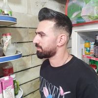 کاشت مو ویژه 13میلیون تومان vip|خدمات آرایشگری و زیبایی|تهران, جنت‌آباد جنوبی|دیوار