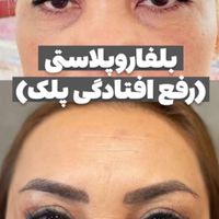 خدمات زیبایی و درمانی به صورت نقد و اقساط|خدمات آرایشگری و زیبایی|تهران, دولت‌آباد|دیوار