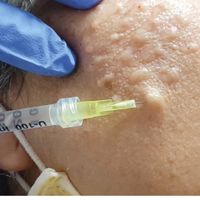 جوانساز روشنی پوست و زیر چشم و تقویت رویش موفقط490|خدمات آرایشگری و زیبایی|تهران, دروازه شمیران|دیوار