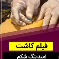 چال لپ پرسینگ دستگاه لاغری امبدینگ مدرک آموزش|خدمات آرایشگری و زیبایی|تهران, پونک|دیوار