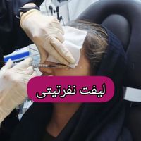 بوتاکس،مزوتراپی،پی آر پی،فیلر توسط پزشک|خدمات آرایشگری و زیبایی|زنجان, |دیوار