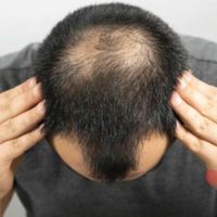 پی ار پی ‌‌‌‌‌‌prp،با کیت بی درد ۶۰۰،جمعه ها|خدمات آرایشگری و زیبایی|تهران, امام حسین(ع)|دیوار