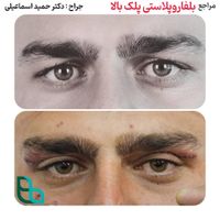 کاشت ابرو در تهران بسیار طبیعی|خدمات آرایشگری و زیبایی|قم, صفائیه|دیوار