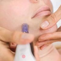 جوانساز روشنی پوست و زیر چشم و تقویت رویش موفقط490|خدمات آرایشگری و زیبایی|تهران, دروازه شمیران|دیوار