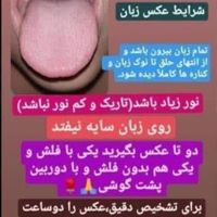 دمنوش کبد چرب|خوردنی و آشامیدنی|تهران, الهیه|دیوار