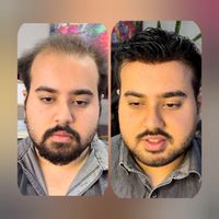 مرکز ترمیم مو /ایران مو /|خدمات آرایشگری و زیبایی|اصفهان, آفاران|دیوار