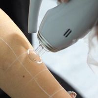 فروش ویژه دستگاه لیزر کندلا با وارانتی عودت دستگاه|پزشکی|تهران, جردن|دیوار