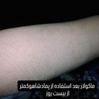 پماد شاهو|آرایشی، بهداشتی، درمانی|تهران, آجودانیه|دیوار