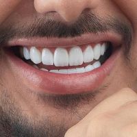 کامپوزیت دندان،لمینیت،روکش،عصب کشی|خدمات آرایشگری و زیبایی|تهران, شهرک غرب|دیوار