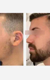 جذابیت اتفاقی نیست