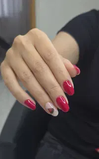 کاشت و ترمیم با متریال عالی