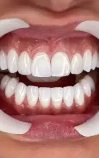 جشنواره دندانپزشکی در استان اردبیل (اقساط ۲۴ ماهه)