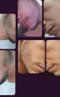 ریشوموی. ضخیم. زیر ۳۰روز.
