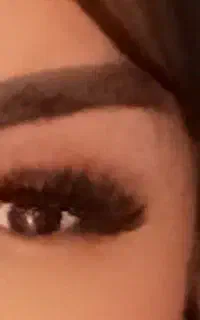کاشت مژه