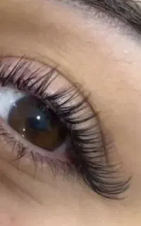 کاشت هرمدل مژه