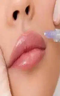 ژل و بوتاکس