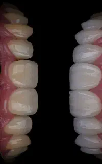 دندانپزشکی،ایمپلنت،ارتودنسی لمینت وکامپوزیت اقساطی